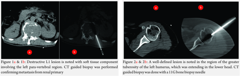 izen imaging mri ct scan usg xray interventions