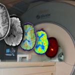 mri