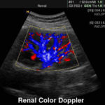 renal-ul-image
